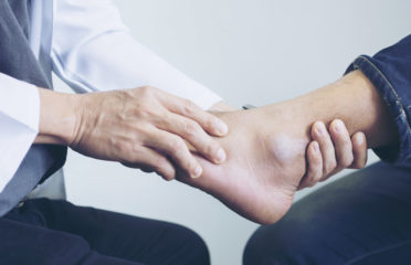 Comprehensive Foot & Ankle Center of South Jersey